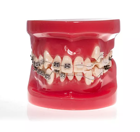 Модель демонстраційна ортодонтична з брекетами
