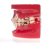 Модель демонстраційна ортодонтична з брекетами, фото 2