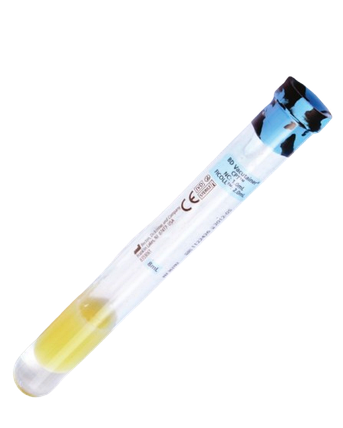 362781 Пробірки вакуумні для виділення мононуклеарів BD Vacutainer® СРЕ 4мл, фото 1