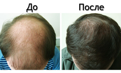 Оригинал! Лечебная эссенция, активатор и восстановление роста волос "Yuda Hair Growth Rilatory" (30ml). - фото 4 - id-p453953508