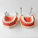 Стоматологічна модель щелепи людини RESTEQ з 28 знімними зубами — анатомічний тренажер для студентів та лікарів, фото 6
