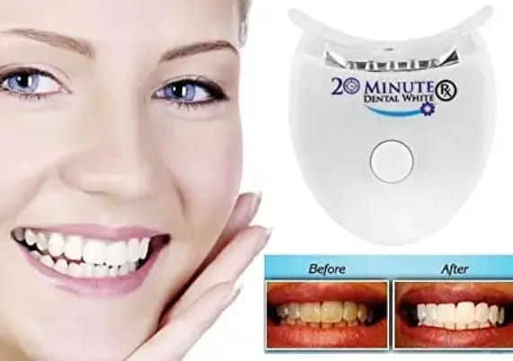 Набір для вибілювання зубів Smile Veneers, фото 1