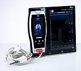 Монітор пацієнта з пульсоксиметром Masimo Root RDS7 Patient Monitor with Pulse Oximeter SpO2 Masimo Radical 7, фото 2