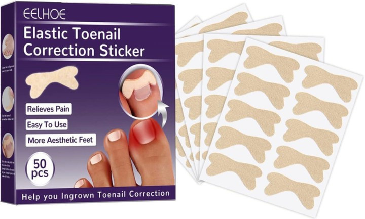 Ефективний набір для корекції врослих нігтів Elastic Toenail Correction Sticker 50 шт