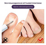 Ефективний набір для корекції врослих нігтів Elastic Toenail Correction Sticker 50 шт, фото 5