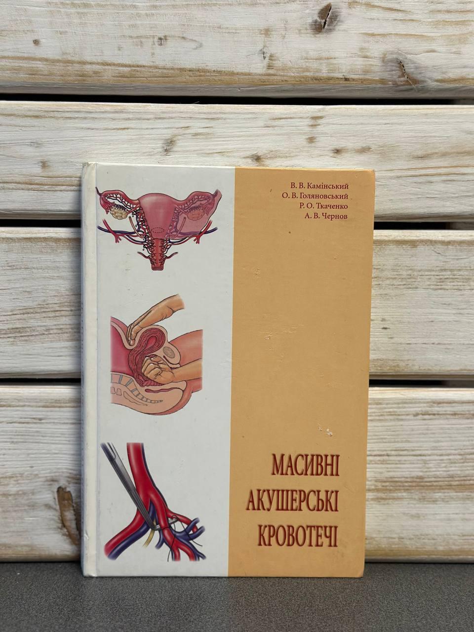 "Масивні акушерські кровотечі" Камінський В.В., Голяновський О.В.