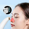 Вакуумний апарат для очищення обличчя, + 6 насадок, USB, XL-1111 / Очищувач пор обличчя / Очищувач чорних крапок, фото 8