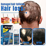 Набір для росту бороди та волосся сироватка BUNEE 5% та дермаролер 540 титанових голок 0.5 мм, фото 7