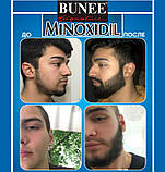 Для росту та догляду за бородою та вусами Beard, сироватка пришвидшувач росту бороди, бальзам, фото 3