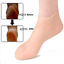 Силіконові шкарпетки для ніг, зволоження та догляд за шкірою ніг, фото 6