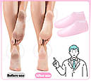 Силіконові шкарпетки для ніг, зволоження та догляд за шкірою ніг, фото 2