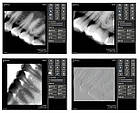 Інтраоральний радіовізіограф - DTS Iplus-sensor, фото 8