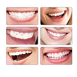 Набір для оздоблення зубів Jaysuing стрази скайси зубні, фото 3