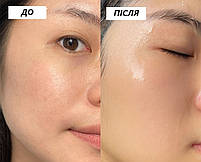 Універсальна 3D силіконова маска для закріплення тканинних, гідрогелієвих та глиняних масок 29254, фото 9