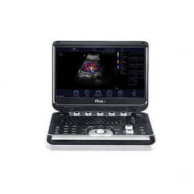 Finus 45 + 2 датчика портативна ультразвукова діагностична система середнього класу Focus&Fusion