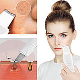 Апарат для кавітаційного пілінгу Cosmetology Shovel — PK-574 nf, білий, фото 8