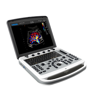 Ультразвуковий апарат SonoBook 6