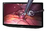 Медичні монітори Sony 4K 3D LCD (LMD-XH550T), фото 8