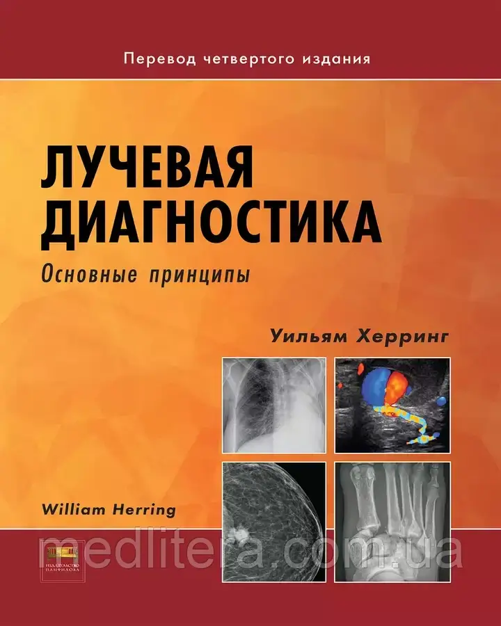 Вільям Херринг. Променева діагностика Основні принципи посібник з рентгенографії, КТ, МРТ та УЗД