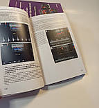 Ультразвукове дослідження при захворюваны артерій і вен нижніх кінцівок Носенко Дадова, фото 3