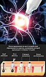 Коагулятор плазмовий Plasma Pen/ Електрокоагулятор/ Бездротова ручка для видалення папілом і бородавок, фото 6