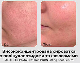 Антивікова ліфтинг-сироватка з PDRN та екзосомами - Medi peel Phyto Exosome PDRN Lifting Shot Serum 50мл, фото 6