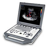 Апарати ультразвукової діагностики