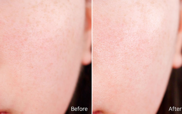 Заспокійливий крем-гель із пантенолом Needly Panthenol Water Gel Cream