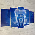 Картина в стоматологію зі скла, Синій зуб, Акварель ефект, 5 модулів, фото 3