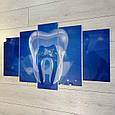 Картина в стоматологію зі скла, Синій зуб, Акварель ефект, 5 модулів, фото 2