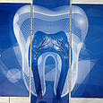 Картина в стоматологію зі скла, Синій зуб, Акварель ефект, 5 модулів, фото 6