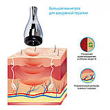 Апарат ударно-імпульсного вакуумного термомасажу Drumroll V-03 REDesign, фото 8