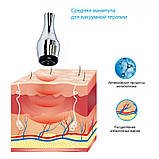 Апарат ударно-імпульсного вакуумного термомасажу Drumroll V-03 REDesign, фото 9