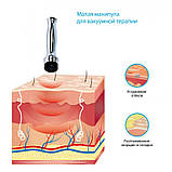 Апарат ударно-імпульсного вакуумного термомасажу Drumroll V-03 REDesign, фото 10
