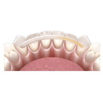 Шинуючі стрічки