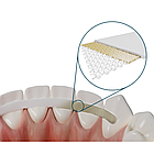 Dentapreg Splint, Дентапрег, Шинирувальна стрічка SFM, 50х2х0,2 мм, фото 5