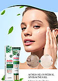 Крем гель проти акне та прищів з олією чайного дерева SADOER TEA TREE ACNES OIL CONTROL GEL 20 мл, фото 3