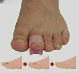 Силіконовий коректор випрямляч великого, другого, третього та безіменного пальців стопи комплект 2 шт., фото 4