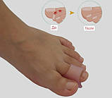 Силіконовий коректор випрямляч великого, другого, третього та безіменного пальців стопи комплект 2 шт., фото 5