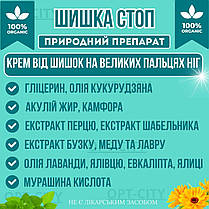 Крем Шишка Стоп 2 флакони засіб від шишок на великих пальцях ніг від болю, фото 4