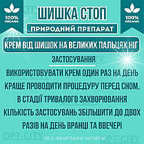 Крем Шишка Стоп 2 флакони засіб від шишок на великих пальцях ніг від болю, фото 5