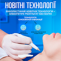 Електрокоагулятор плазмовий прилад для видалення папілом бородавок VLVEE професійний апарат (VLV-5163), фото 9