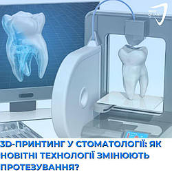 3D-принтинг у стоматології: як новітні технології змінюють протезування?