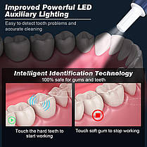 Набір для чищення зубів Dental Wand з камерою | Видаляє наліт, плями, зубний камінь і зубний камінь | Акумулят, фото 6