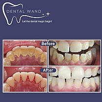 Набір для чищення зубів Dental Wand з камерою | Видаляє наліт, плями, зубний камінь і зубний камінь | Акумулят, фото 3