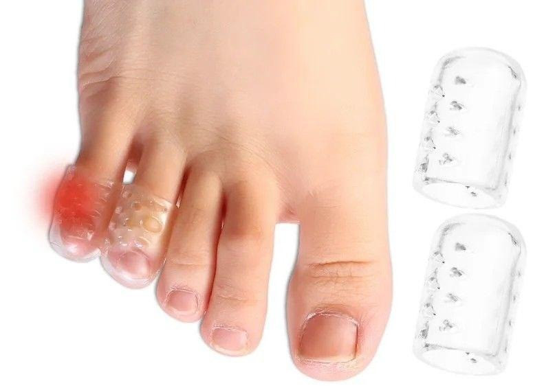 Силіконовий бандаж на пальці ніг, 10 шт/набір