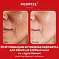 Medi-Peel Melanon X Ampoule – ампульна сироватка для обличчя з арбутином і глутатіоном, 50 мл, фото 4