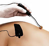 Насадка для електростимулятораз голчастим колесом, фото 3
