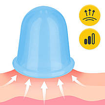 Вакуумні масажні банки 4FIZJO силіконові для тіла (китайські/антицелюлітні банки) 5 шт 4FJ0345 Poland, фото 4