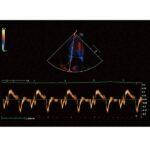 УЗД апарат для тварин Vetus 9 Premium Mindray Animal, фото 2